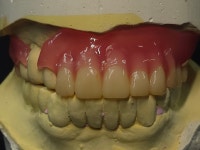 뉴티스치과기공소