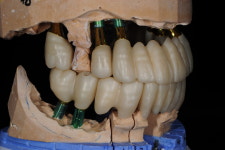 스마일라인치과기공소