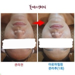 꽃피는스킨바디