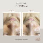 로얄 뷰티 영 스킨앤바디전문점 | 퍼스트뷰티스킨앤바디