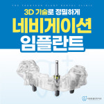 더튼튼플란트치과의원