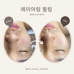 로얄 뷰티 영 스킨앤바디전문점 | 퍼스트뷰티스킨앤바디