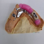 다윗치과기공소