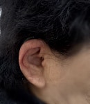 와이덱스보청기 춘천점