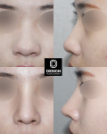 디자인성형외과의원 부산서면역