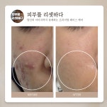 프리뷰티셀플라