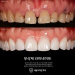 서울더자연치과의원