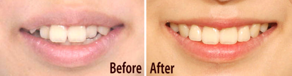 서울수석치과교정과치과의원