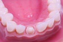 서울탑플란트치과의원