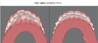 서울수석치과교정과치과의원