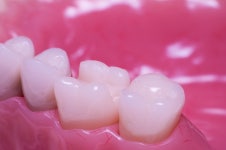 서울탑플란트치과의원