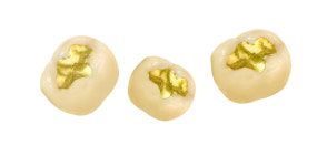 서울탑플란트치과의원