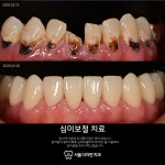 서울더자연치과의원