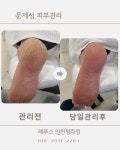 레푸스 청라점