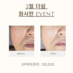 더쉼