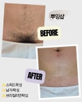 뿌잉왁싱 루원시티본점