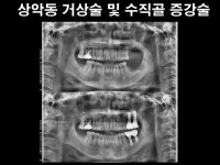 더플랜트치과의원