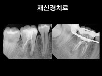 더플랜트치과의원