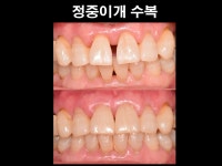 더플랜트치과의원