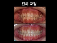 더플랜트치과의원