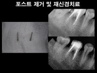 더플랜트치과의원