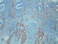 한국CFC병리과의원