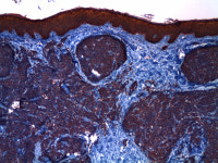 한국CFC병리과의원