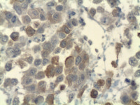 한국CFC병리과의원