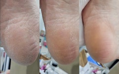 동암네일샵 윤블리네일