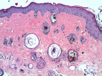 한국CFC병리과의원