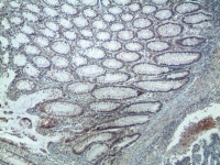 한국CFC병리과의원