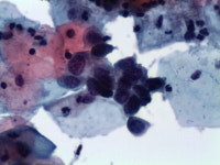 한국CFC병리과의원