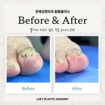 로에성형외과의원
