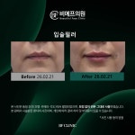 비에프의원