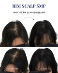 림스칼프 대구본점