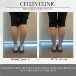 셀린의원 수원망포점