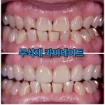 플란트서울치과의원 미금