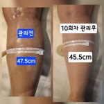 문스킨앤바디