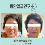 동안애젊어지는동안전문샵 | 동안얼굴연구소