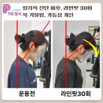 PT의정석 운동재활센터