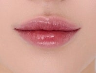 누브의원 선릉