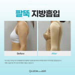 리즈온 위드 연세슬림라인의원