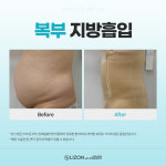 리즈온 위드 연세슬림라인의원