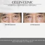 셀린의원 수원망포점