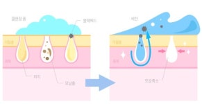 블레스뷰티