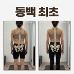 리움체형교정센터 용인동백본점