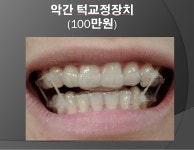 예스부부치과의원