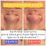 고원장의모공세척테라피 의정부점