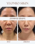 예오미오 스킨케어 의정부금오본점