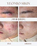 예오미오 스킨케어 의정부금오본점